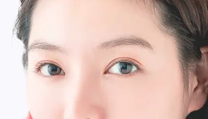 二重整形